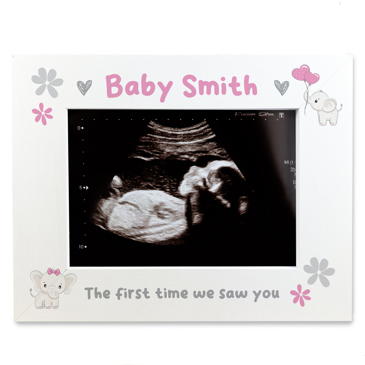 Personalised Baby Scan 7x5 Photo Frame Keepsake Pregnancy Scan