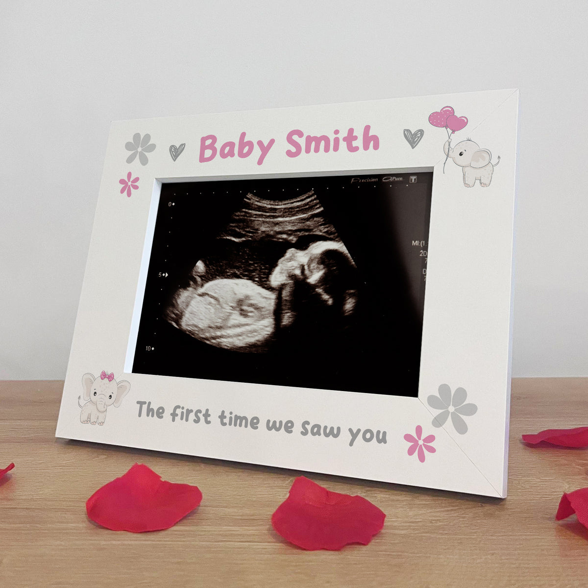 Personalised Baby Scan 7x5 Photo Frame Keepsake Pregnancy Scan
