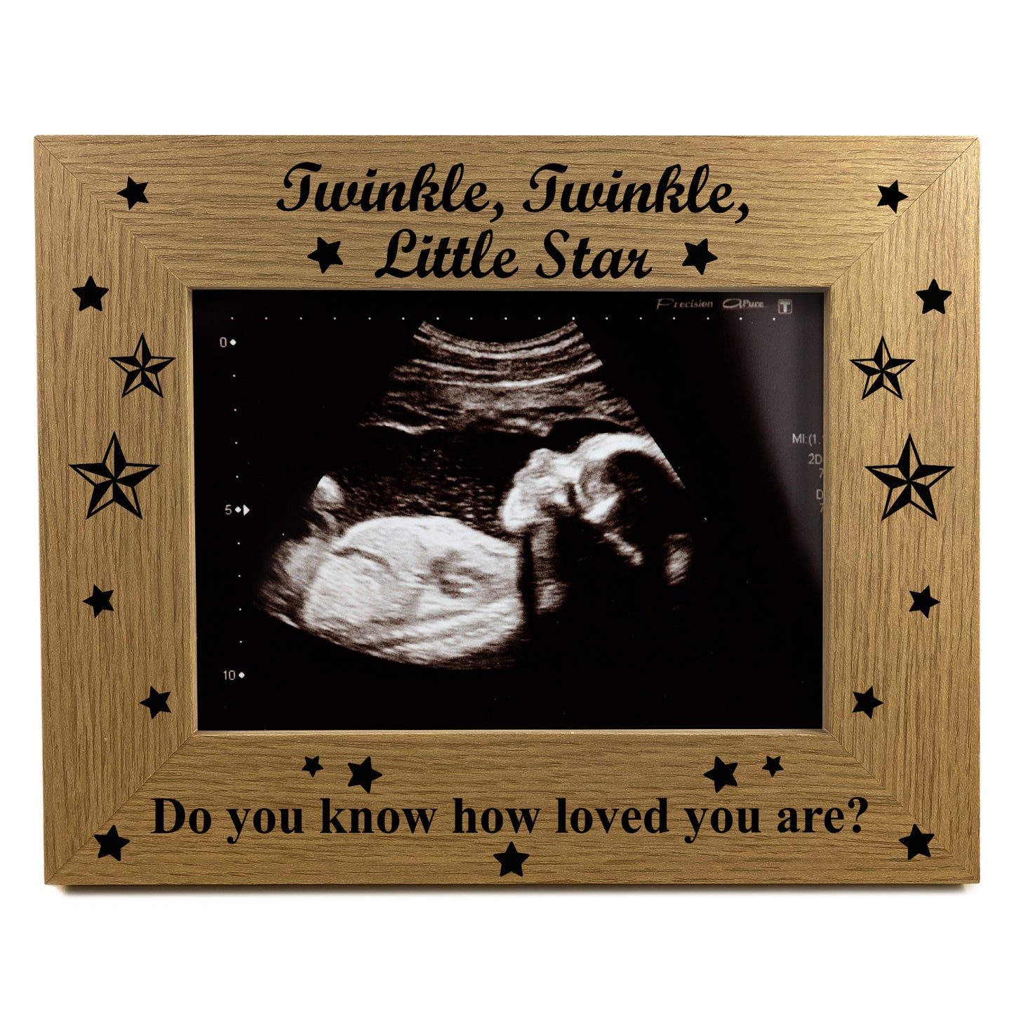 Baby Scan Photo Frame Baby Boy Baby Girl Gift Nursery Decor