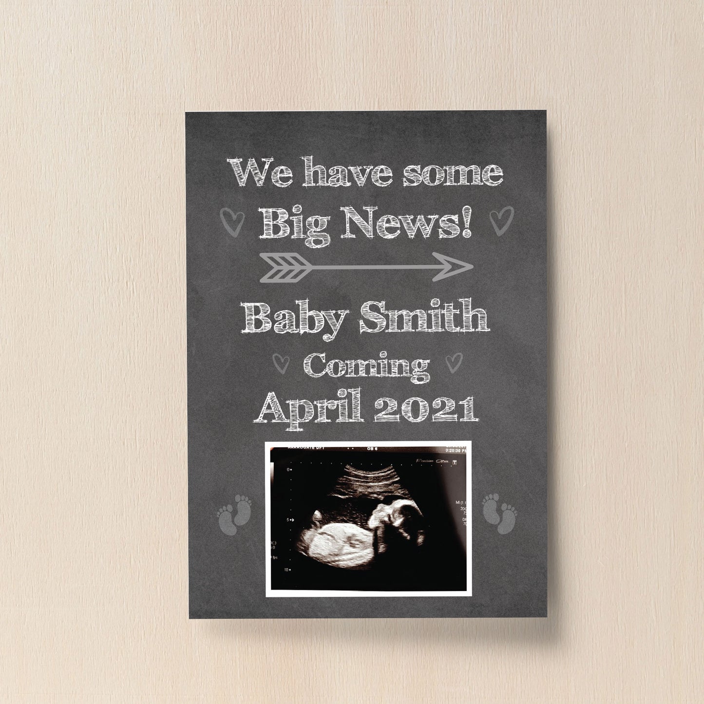 PERSONALISED Scan Image Print Baby Announcement Gift