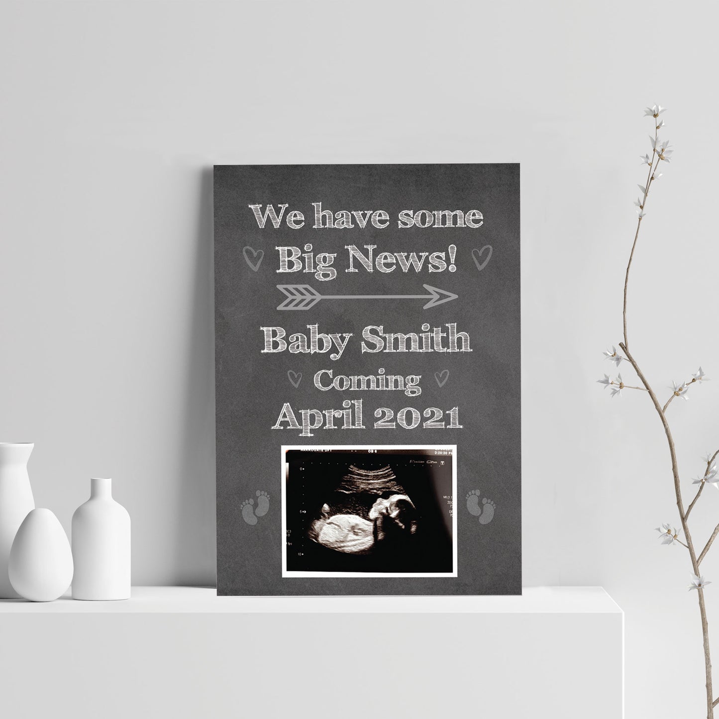PERSONALISED Scan Image Print Baby Announcement Gift