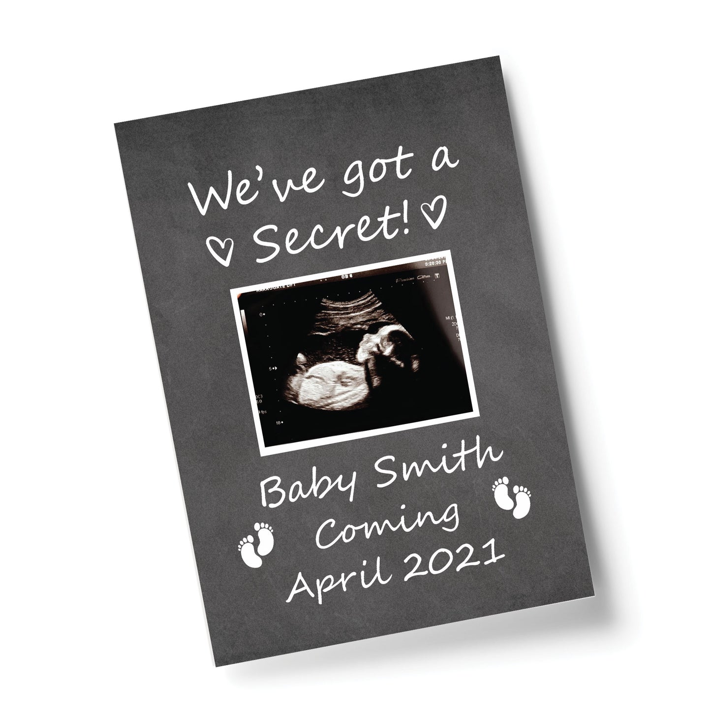Personalised Baby Announcement Print Mummy Daddy To Be Gift